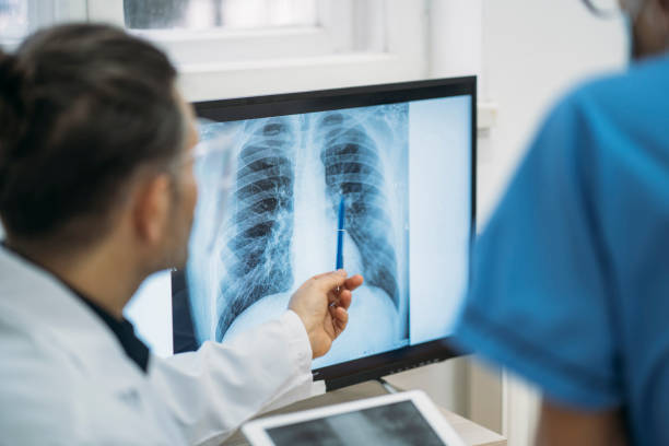 Imagen de médico señalando una radiografía